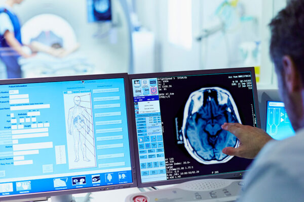 Accidentul vascular cerebral (AVC)