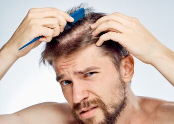 Alopecia